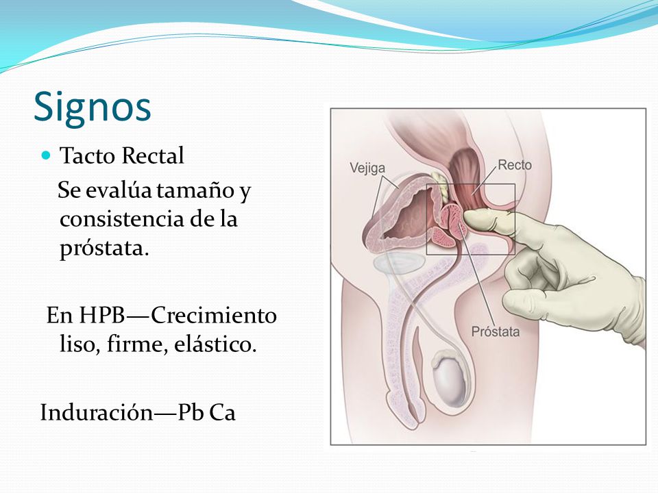consistencia de la próstata consistencia de la próstata
